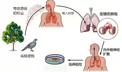 鹦鹉热 不只是鸟类的问题，人传人真相与长期病程解析